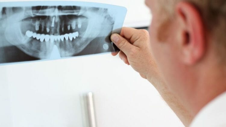 Come scegliere un buon dentista: consigli e aspetti da tenere a mente